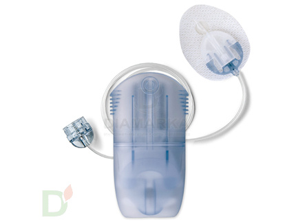 Инфузионный набор MIO30 / МИО30, 13/60см (MMT-905А), 1 шт.