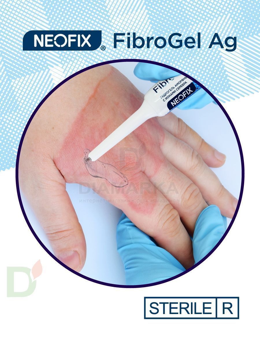 Гидрогель антимикробный NEOFIX FibroGel Fg с ионами серебра 15г в Санкт-Петербурге